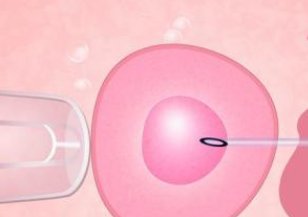 试管婴儿后身体反应，试管后的反应！