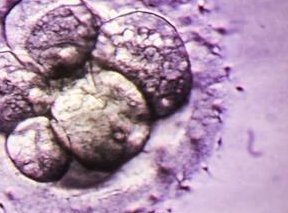 沈阳可以做三代试管的医院有哪些？要准备多少钱？